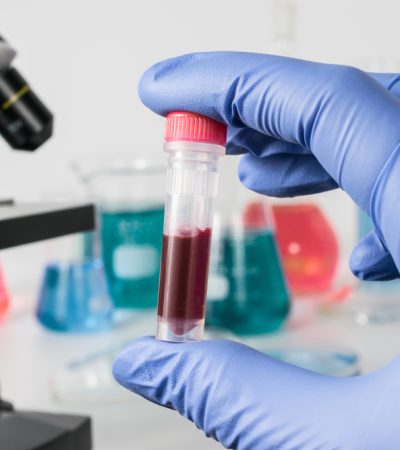 Blood test diagnostics services at home